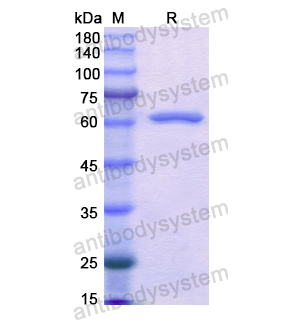 重组AKR1C4蛋白 YHD24301,Recombinant Human AKR1C4, N-GST