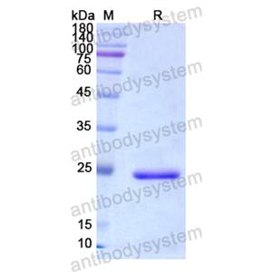 重组CD127/IL7R蛋白,Recombinant Human CD127/IL7R, N-His