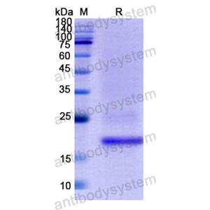 重組FAH蛋白,Recombinant Human FAH, N-His