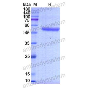 重组RHOQ蛋白,Recombinant Human RHOQ, N-GST