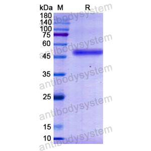 Recombinant Human IFNAR1, N-His