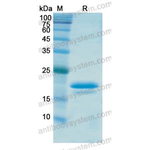 重組CX43/GJA1蛋白,Recombinant Human CX43/GJA1, N-His