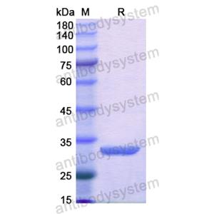 重组AKR1C4蛋白,Recombinant Human SMPD1, N-His