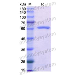 重组AKR1C4蛋白 YHD24301,Recombinant Human AKR1C4, N-GST