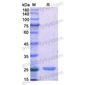 Recombinant Human CTRB1, N-His