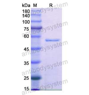 重组CAPN2蛋白,Recombinant Human CAPN2, N-His