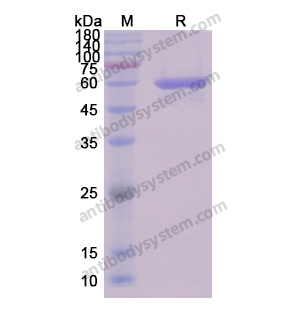 重组DES/Desmin蛋白,Recombinant Human DES/Desmin, N-His