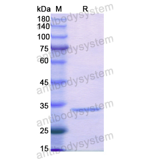 重組PTPN2蛋白,Recombinant Human PTPN2, N-His