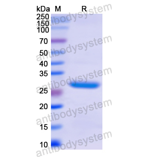 Recombinant Human CD35/CR1, N-His