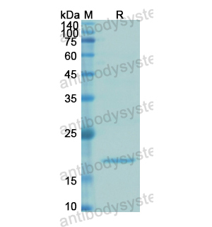 重組IGFBP3蛋白,Recombinant Human IGFBP3, N-His