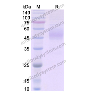 重组FLT1蛋白,Recombinant Human FLT1, C-His