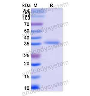 重組ALOX12蛋白,Recombinant Human ALOX12, N-His