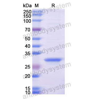 重组ITGB6蛋白,Recombinant Human ITGB6, N-His