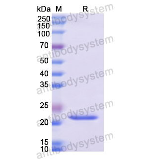 重組LIG1蛋白,Recombinant Human LIG1, N-His