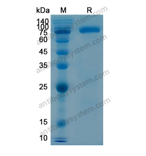 重組CD106/VCAM1蛋白,Recombinant Human CD106/VCAM1, N-His