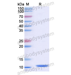 重组NCL蛋白,Recombinant Human NCL, N-His