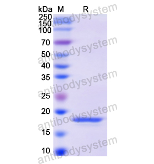 重组HK1蛋白,Recombinant Human HK1, N-His