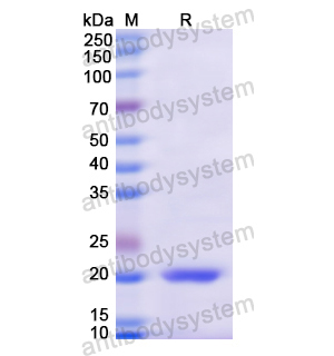 重组CD224/GGT1蛋白,Recombinant Human CD224/GGT1, N-His