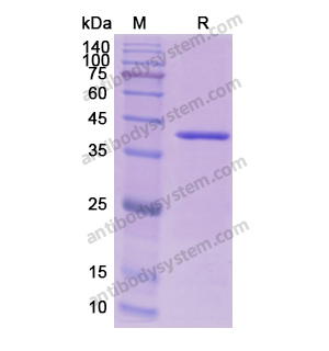 重組AOC1/DAO蛋白,Recombinant Human AOC1/DAO, N-His