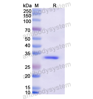 重組ITIH2蛋白,Recombinant Human ITIH2, N-His