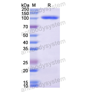 重組NFKB1蛋白,Recombinant Human NFKB1, N-His