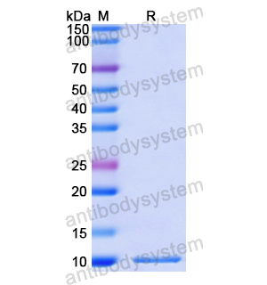 重组CXCL3/GRO-gamma/MIP2-beta蛋白,Recombinant Human CXCL3/GRO-gamma/MIP2-beta, N-His