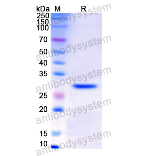 重组KLK2蛋白,Recombinant Human KLK2, N-His