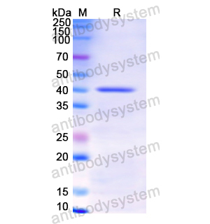 重组TBP蛋白,Recombinant Human TBP, N-His