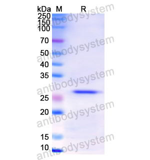 重组CD120b/TNFRSF1B/TNFR2蛋白,Recombinant Human CD120b/TNFRSF1B/TNFR2, N-His