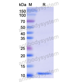 重组RAB5A蛋白,Recombinant Human RAB5A, N-His