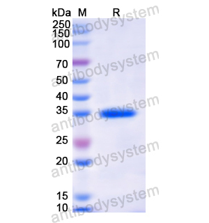 重组MX1蛋白,Recombinant Human MX1, N-His