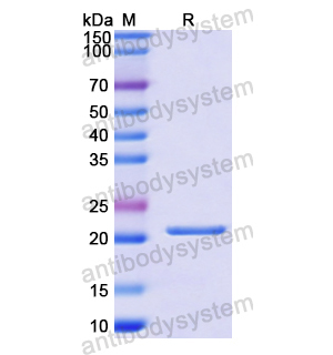 重组IL11蛋白,Recombinant Human IL11, N-His