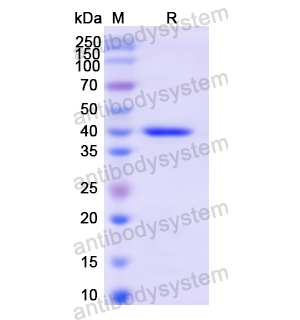 重组CD247/CD3Z蛋白,Recombinant Human CD247/CD3Z, N-GST