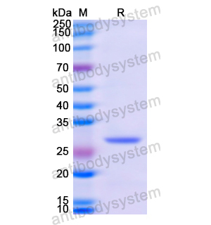 重组GSTM3蛋白,Recombinant Human GSTM3, N-His