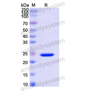 重组TACR2蛋白,Recombinant Human TACR2, N-His