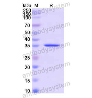 重组SYT1蛋白,Recombinant Human SYT1, N-His