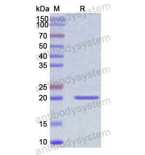 重组KITLG/SCF蛋白,Recombinant Human KITLG/SCF, N-His