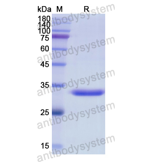 重组CD204/MSR1蛋白,Recombinant Human CD204/MSR1, N-His