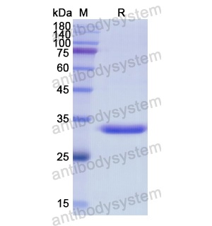 重組CD204/MSR1蛋白,Recombinant Human CD204/MSR1, N-His