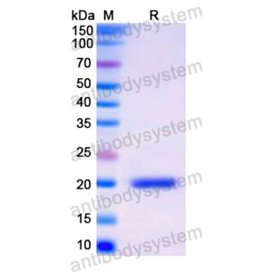 重组CD22蛋白,Recombinant Human CD22, N-His