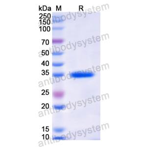 Recombinant Human MX1, N-His