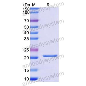 重组IL11蛋白,Recombinant Human IL11, N-His