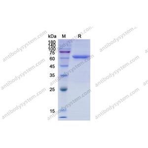 重组CD73/NT5E蛋白,Recombinant Human CD73/NT5E, C-His