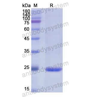 重组CD72蛋白,Recombinant Human CD72, N-His