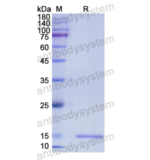 重組DRD5蛋白,Recombinant Human DRD5, N-His