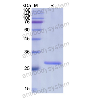 重组MMUT蛋白,Recombinant Human MMUT, N-His