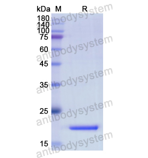 重組IL10蛋白,Recombinant Human IL10, C-His