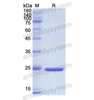 重组IDS蛋白,Recombinant Human IDS, N-His