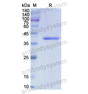 重組CD334/FGFR4蛋白,Recombinant Human CD334/FGFR4, N-His