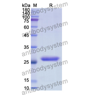 重組ALAS2蛋白,Recombinant Human ALAS2, N-His